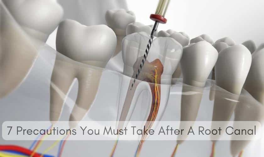 7 Precautions You Must Take After A Root Canal - Westar Dental
